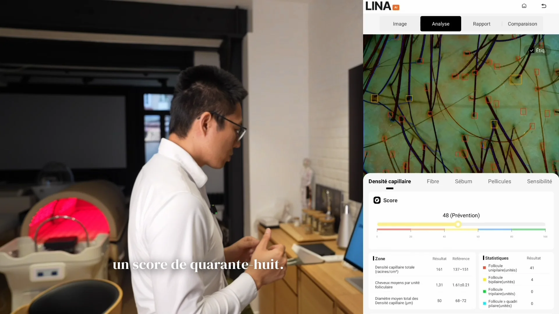 Démonstration LinaVision : prise de vue et analyse du cuir chevelu sur la tablette