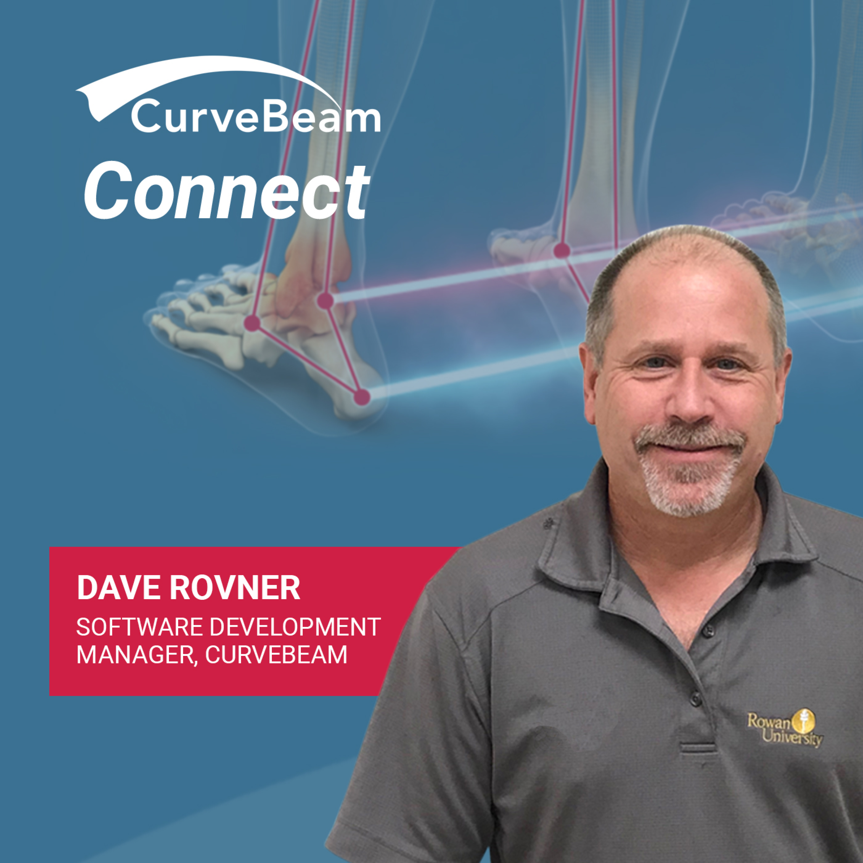 CurveBeam AI Cast