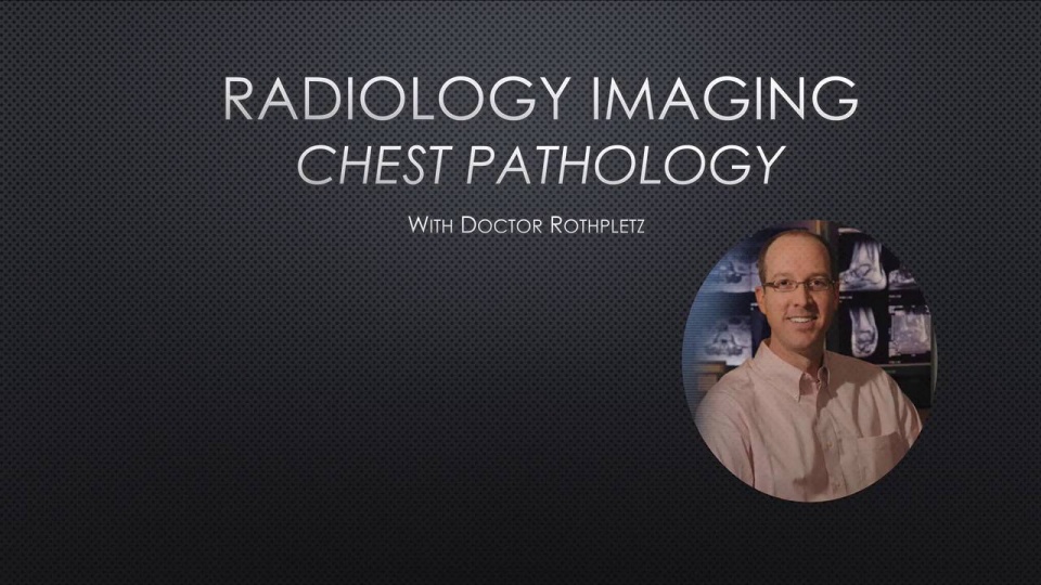 Chest Anatomy and Pathology | Video Lesson | Clover Learning