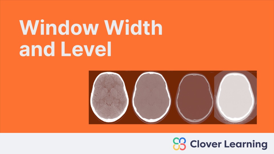 Window Width and Level | Video Lesson | Clover Learning