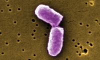 DNA and Protein Synthesis 