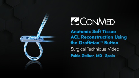 Dr. Gelber - Anatomic Soft Tissue ACL Reconstruction Using the GraftMax™ Button