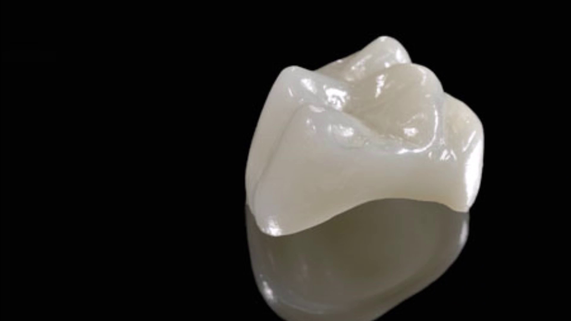 Lee Family and Cosmetic Dentistry: Dental Crowns - Lee Family and Cosmetic  Dentistry Videos