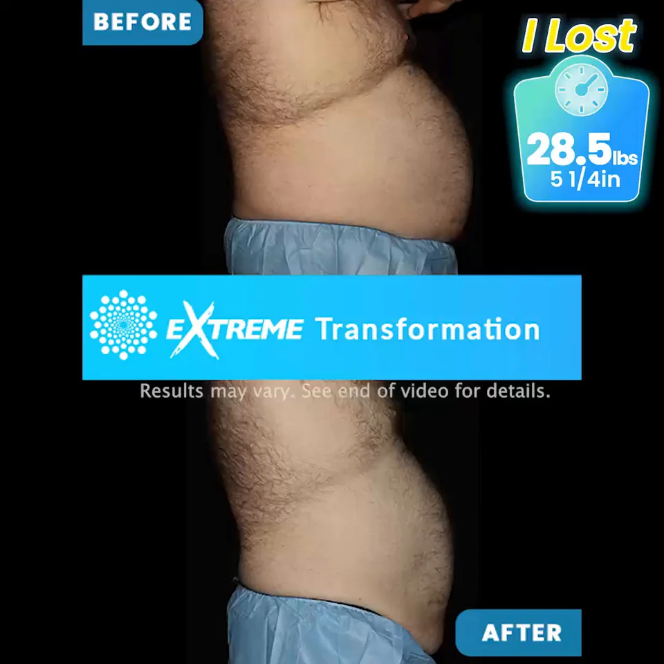 Bodenvy Orlando | Get Your CoolSculpting Pricing Bodenvy Orlando | Get Your CoolSculpting Pricing