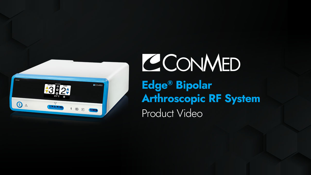 エッジ システムを使用した関節鏡視下双極 RF 切除術 | CONMED