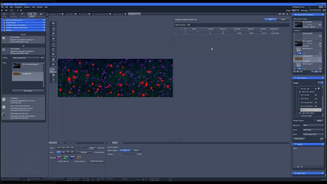 Webinar: Cell Census to Synapses with Axio Observer 7