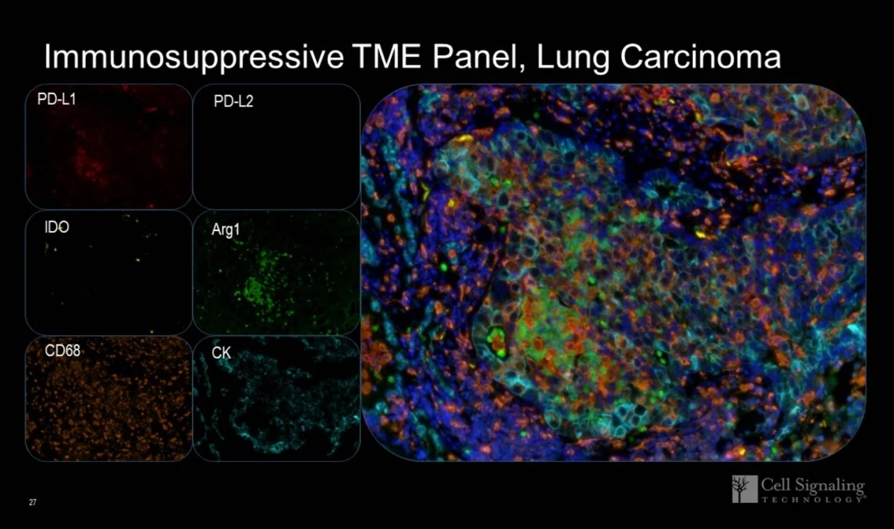 Mechanisms of Myeloid Immunosuppression: Functional Characterization of the  Tumor Microenvironment Using Single and Multiplex IHC 18-IMM-19493