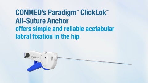 Paradigm® ClickLok™ - Product Video