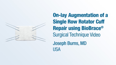 Dr. Burns - On-lay Augmentation of a Single Row Rotator Cuff Repair using BioBrace®