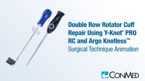 CuffLink™ Double Row Rotator Cuff Repair Using Y-Knot® PRO RC and Argo Knotless®