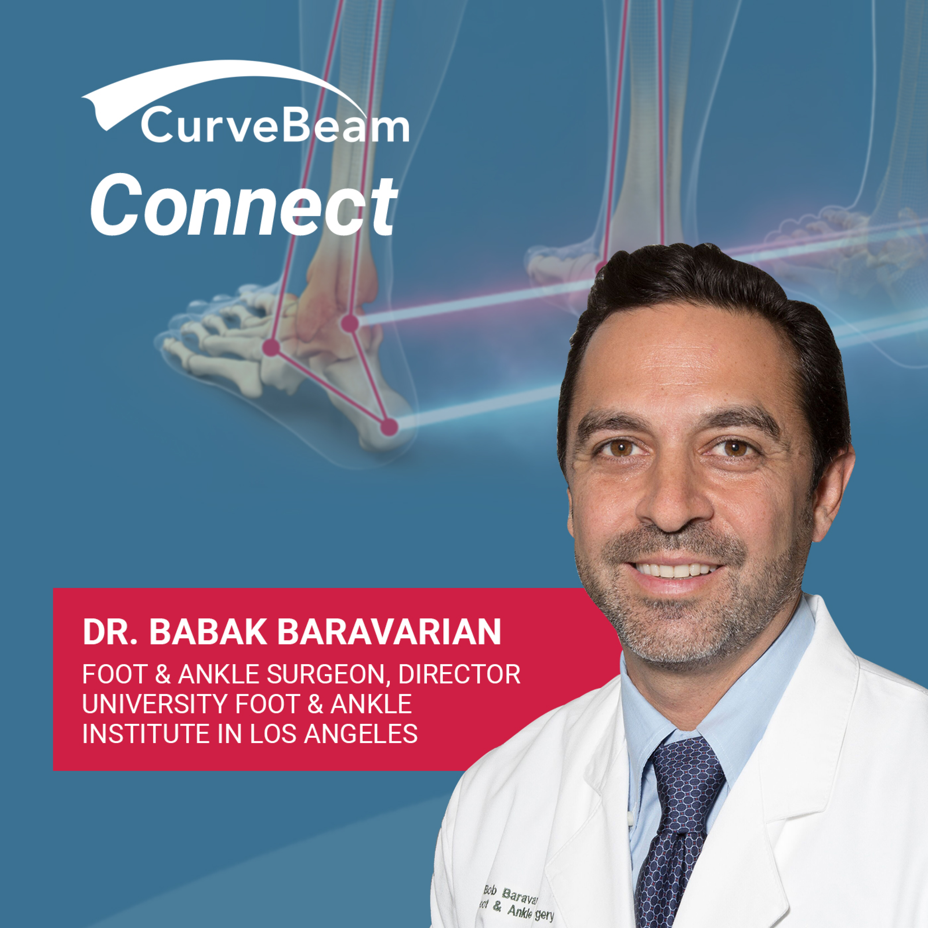 CurveBeam AI Cast