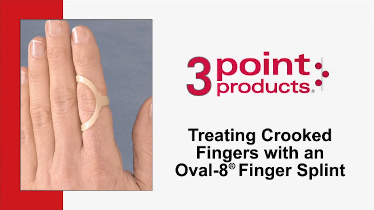 How to Treat Lateral Deviation with an Oval-8 Finger Splint