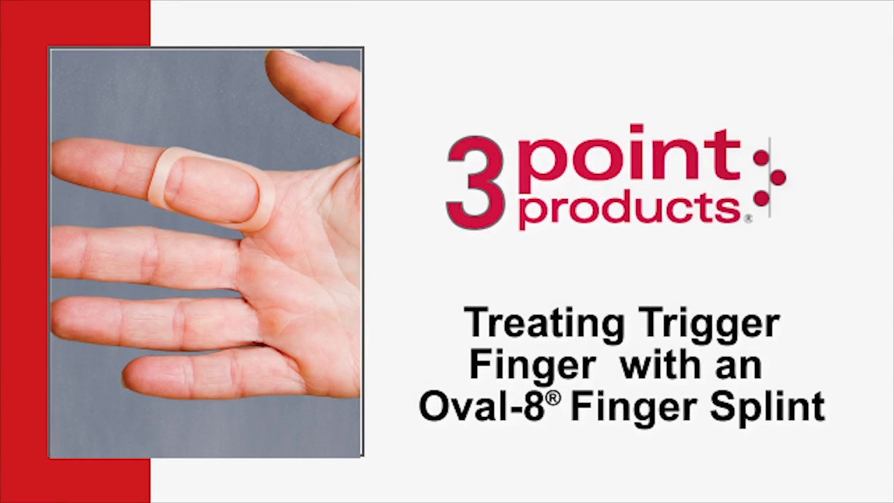 How to Treat Trigger Finger with an Oval-8 Finger Splint