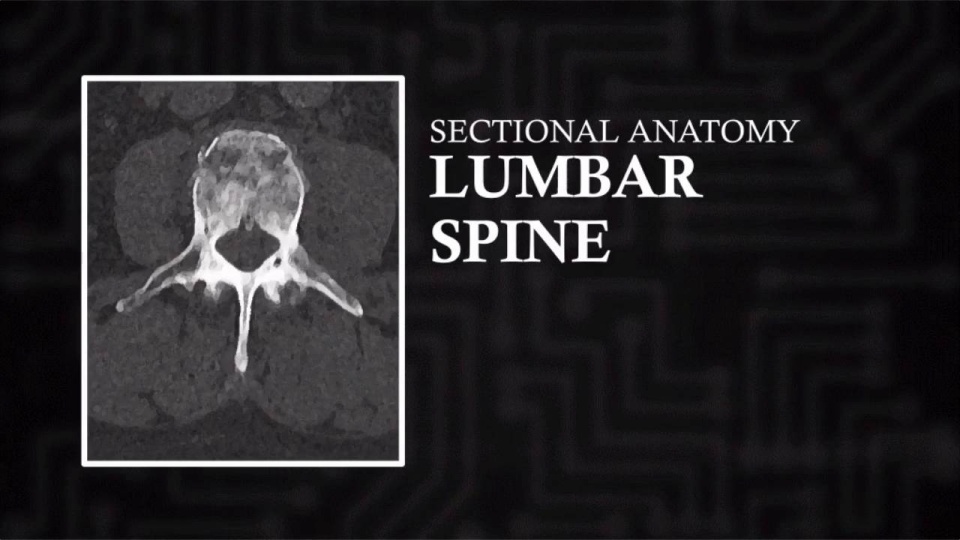 Ct Lumbar (axial) 