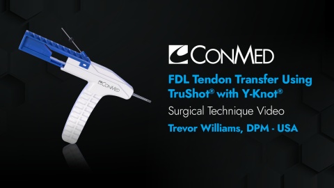 Dr. Williams - FDL Tendon Transfer Using TruShot® with Y-Knot®