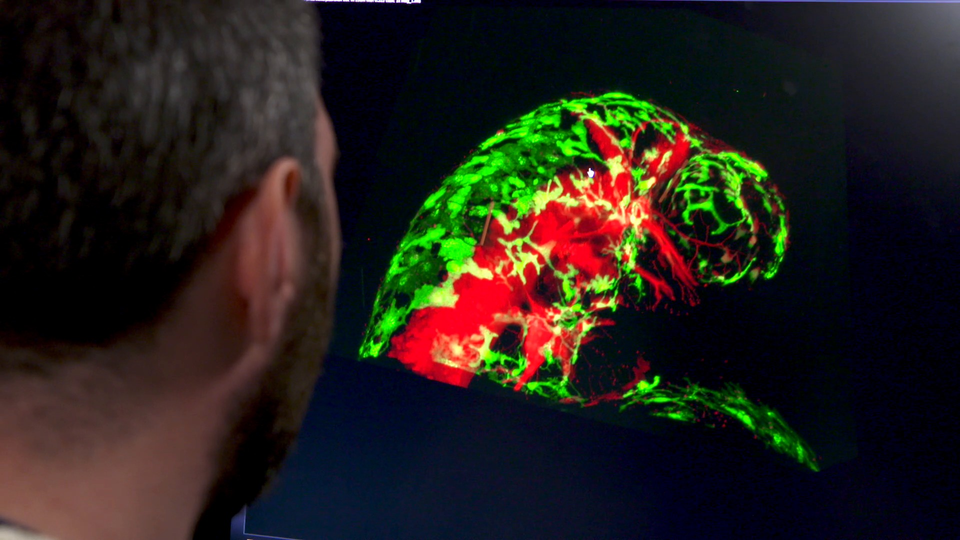 共焦点顕微鏡 Dragonfly: 100を超える科学論文で採用された革新の