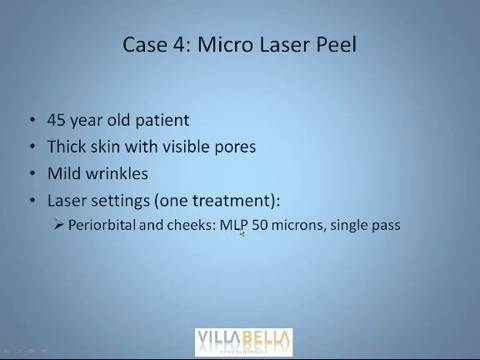 Thumbnail for New Advances in Combination Skin Rejuvenation and Fractional Laser Treatment