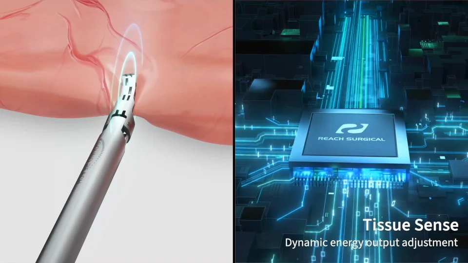 Ultrasonic Scalpel System | SOUND REACH CSUS 8000