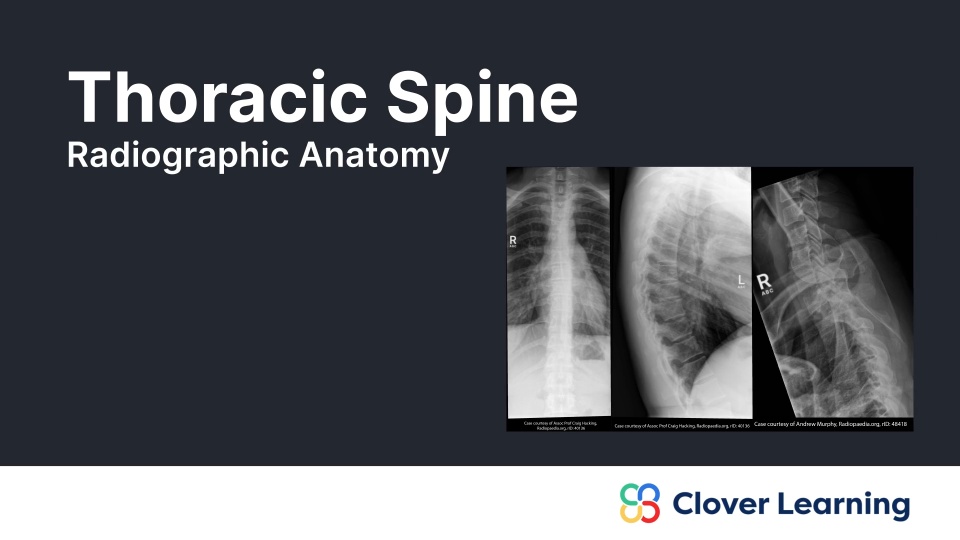 Human Thoracci Radiograph Thoracic Spine: Radiographic Anatomy | Video Lesson | Clover Learning