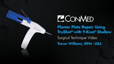 Dr. Williams - Plantar Plate Repair Using TruShot® with Y-Knot® Shallow