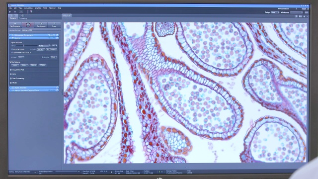 Master Kohler Illumination for Perfect Imaging