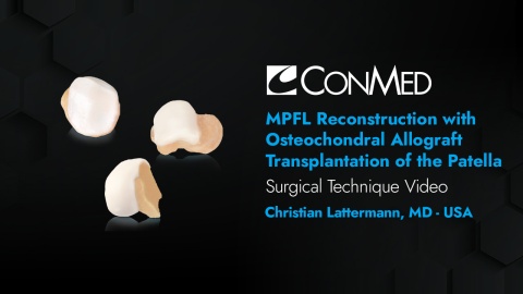 Dr. Lattermann - MPFL Reconstruction with Osteochondral Allograft Transplantation of the Patella