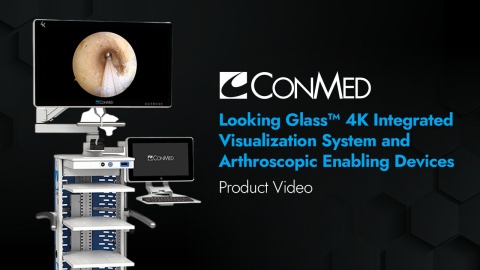 Looking Glass™ 4K Integrated Visualization System and Arthroscopic Enabling Devices - Product Video