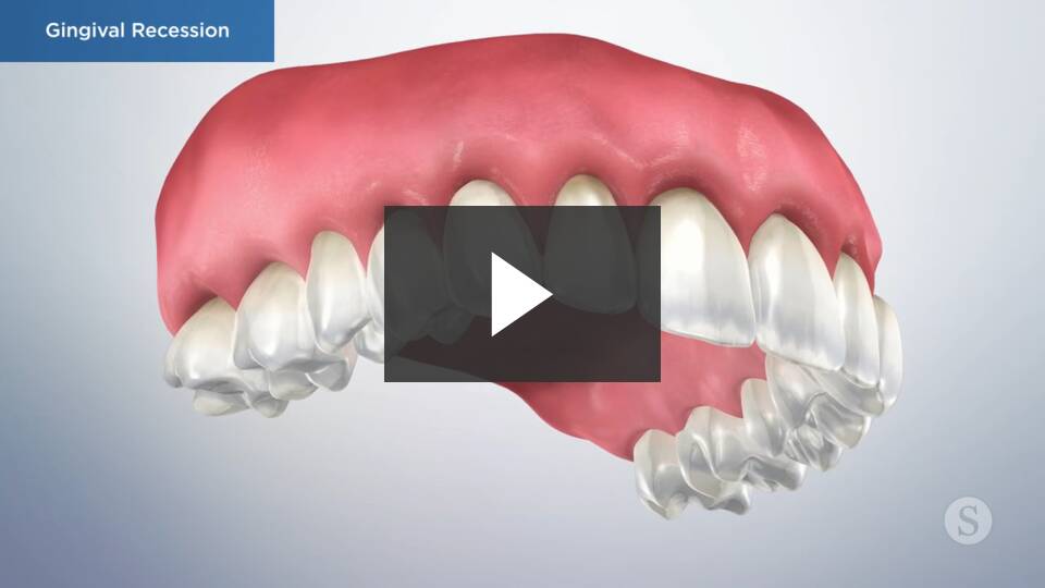 Link Dental - Cosmetic Dentistry in Denver -