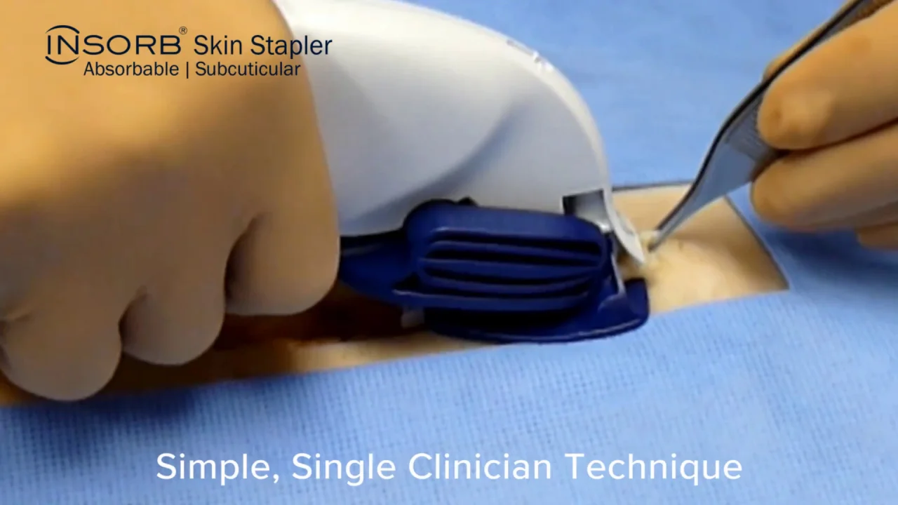 INSORB subcuticular skin stapler Details about   Skin Stapler 