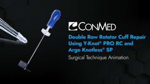 CuffLink™ Double Row Rotator Cuff Repair Using the Y-Knot® PRO RC and Argo Knotless® Self-Punching Anchor