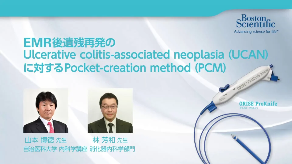 【一部公開】EMR後遺残再発のUlcerative colitis-associated neoplasia (UCAN)  に対するPocket-creation method (PCM)