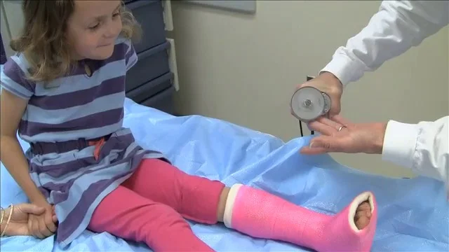 Getting a Cast and Getting a Cast Removed