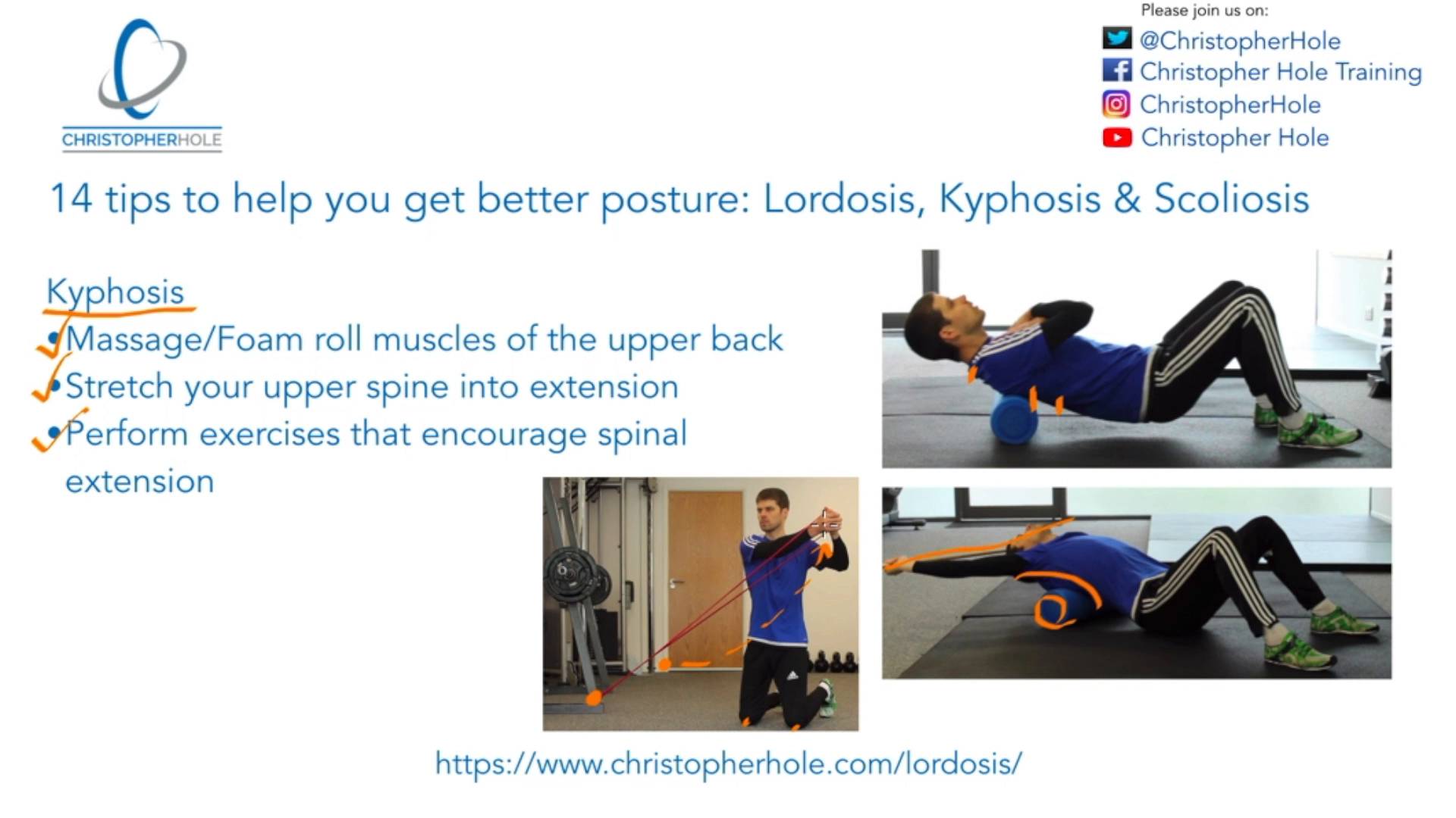 Kyphosis Lordosis Exercises