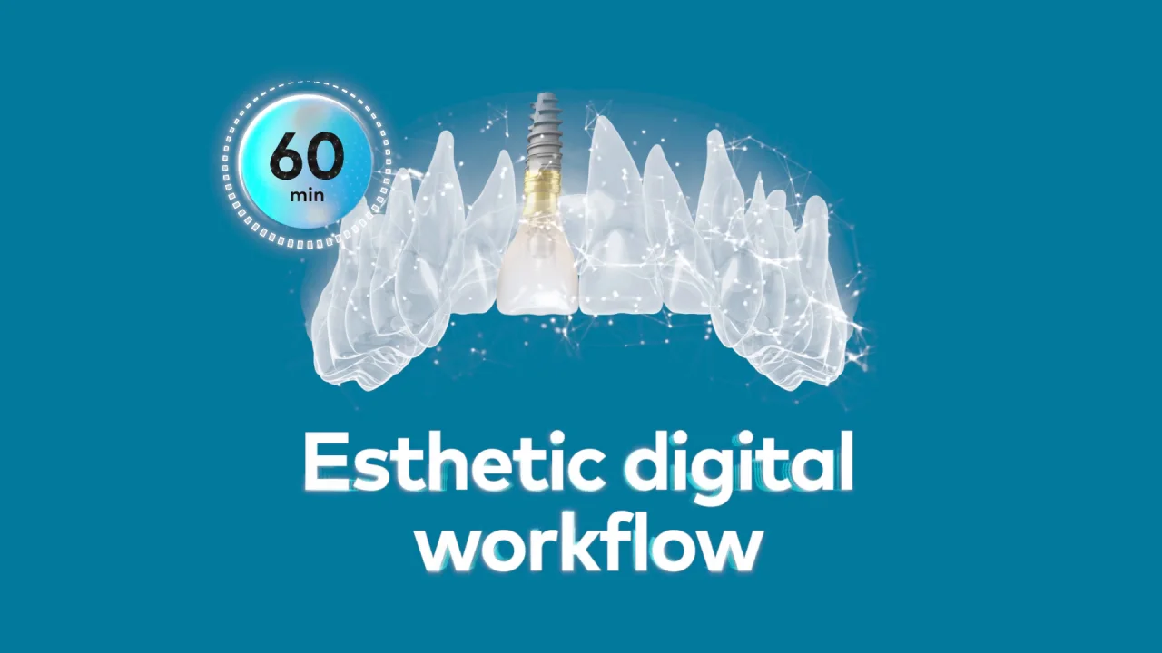 Esthetic digital workflow | Own the esthetic zone