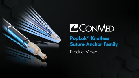 PopLok® Knotless Suture Anchor - Product Video