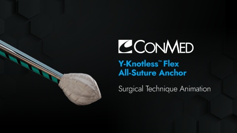 Y-Knotless™ Flex All-Suture Anchor for Labral Repair