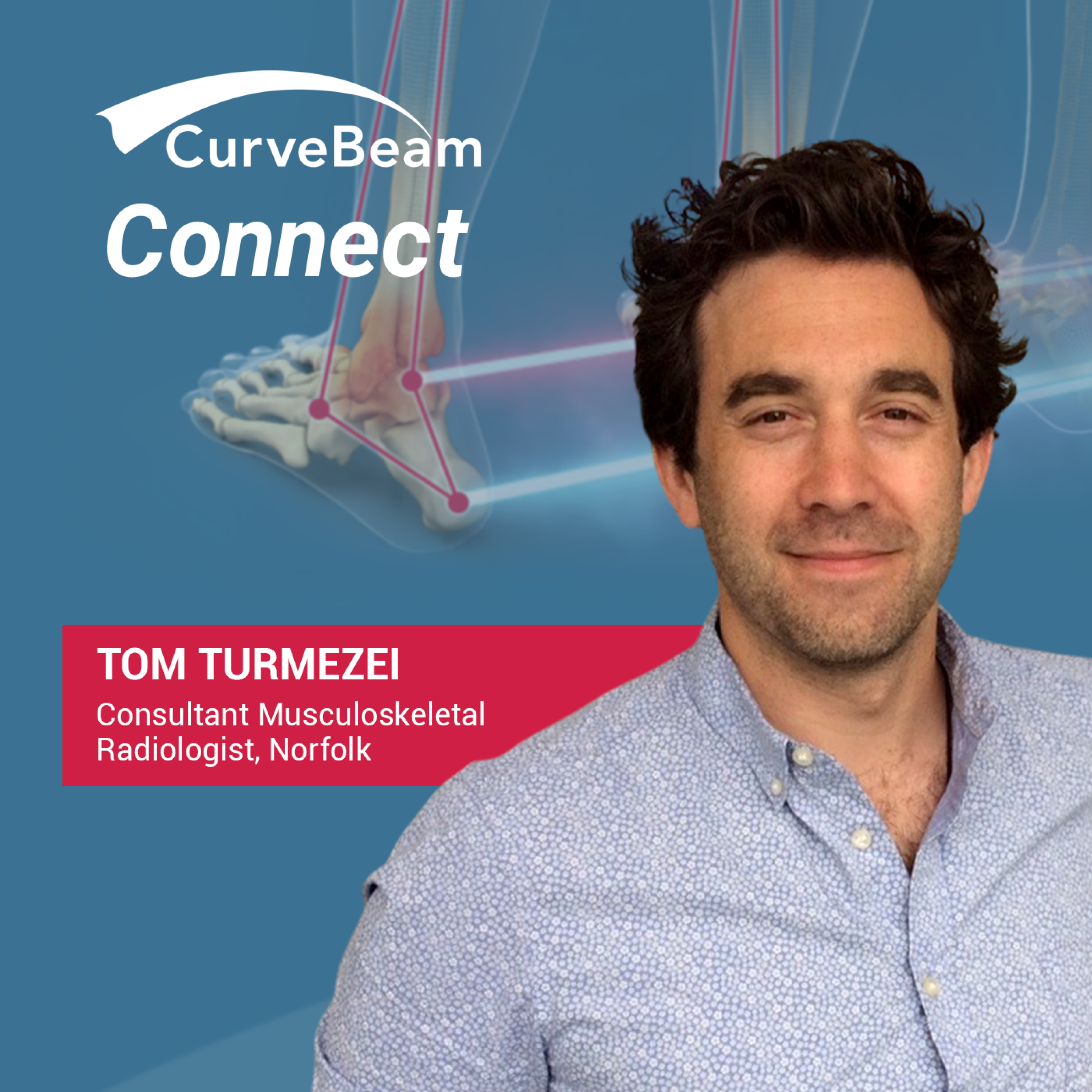 CurveBeam AI Cast