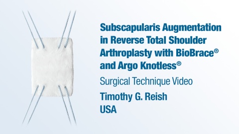 Dr. Reish - Subscapularis Augmentation in Reverse TSA with BioBrace® and Argo Knotless®