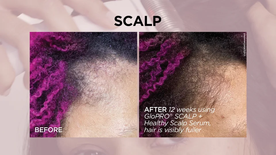 BeautyBio Get That Glow GloPRO® Facial Microneedling Discovery Set