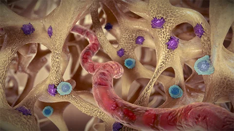 Osteoporosis Diagnosis & Treatment by Top Bone Doctors - Baltimore, MD Osteoporosis Diagnosis & Treatment by Top Bone Doctors - Baltimore, MD