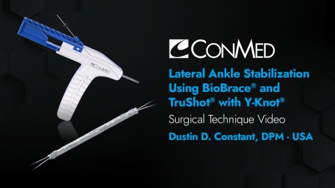 Dr. Constant - Lateral Ankle Stabilization Using BioBrace® and TruShot®