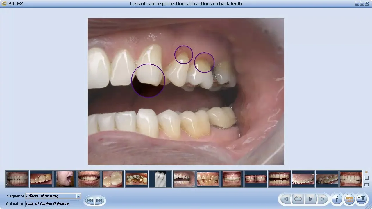 what does it mean if you have canine teeth