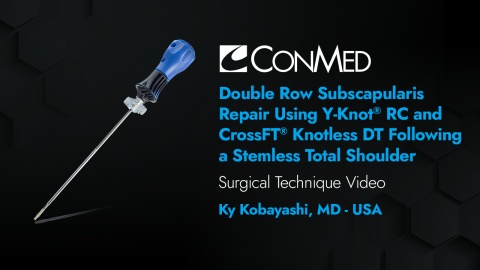 Dr. Kobayashi - Double Row Subscapularis Repair Using Y-Knot® RC and CrossFT® Knotless DT Following a Stemless Total Shoulder