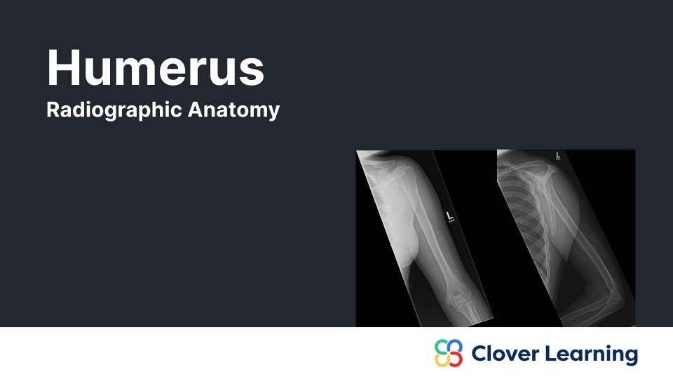 Humerus: Radiographic Anatomy | Video Lesson | Clover Learning