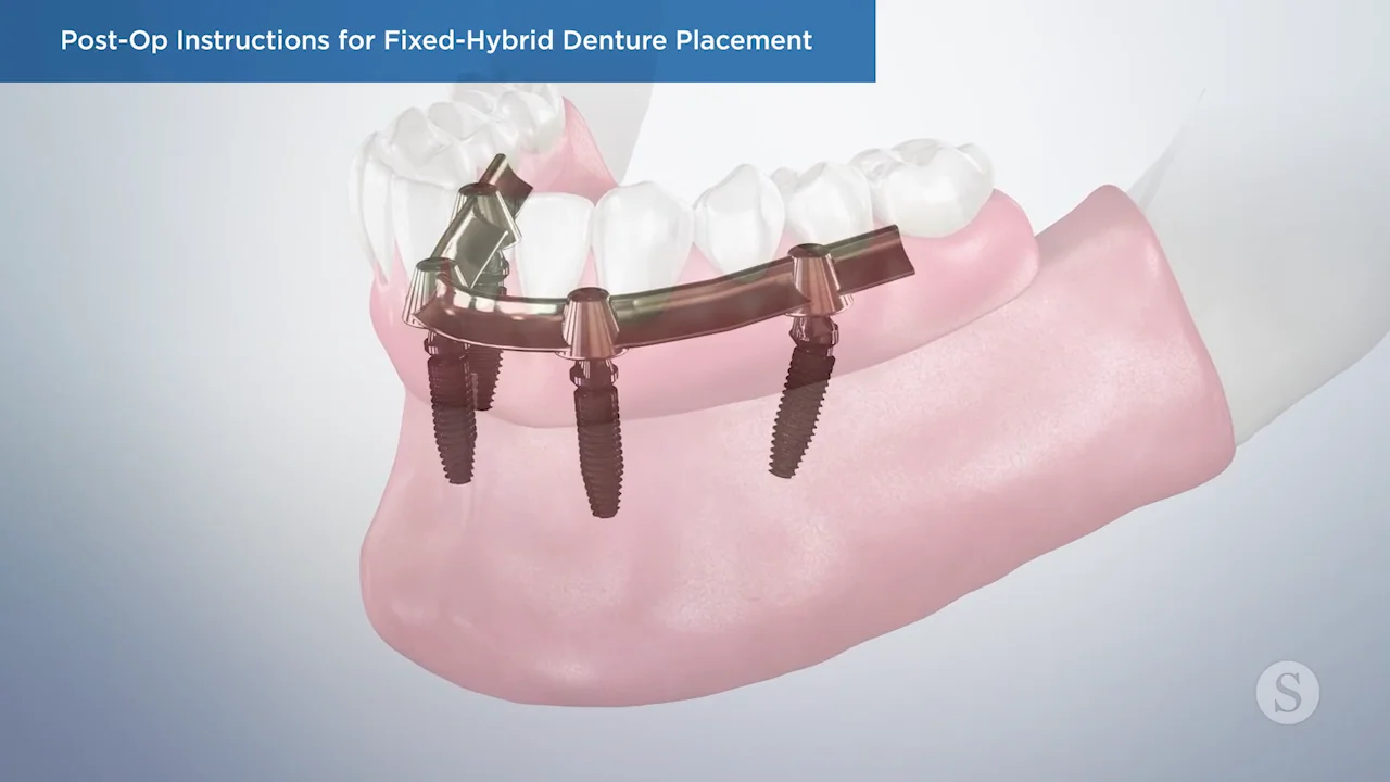 Easy Tips for Cleaning Dentures Effectively Joshua A. Holcomb DDS Blog