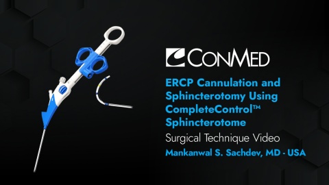 Dr. Sachdev - ERCP Cannulation and Sphincterotomy Using CompleteControl™ Steerable Sphincterotome