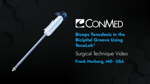 Dr. Norberg - Biceps Tenodesis in the Bicipital Groove Using TenoLok®