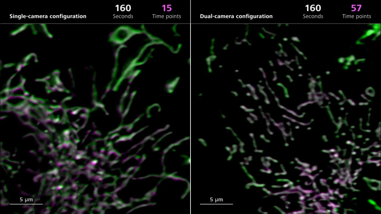 ZEISS Lattice Lightsheet 7 - U2OS mitotracker co-localization