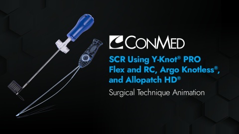 SCR Using Y-Knot® PRO Flex, Y-Knot® PRO RC, Argo Knotless®, and Allopatch HD®