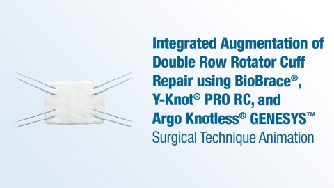 Integrated Augmentation of Double Row Rotator Cuff Repair Using BioBrace®, Y-Knot® PRO RC, and Argo Knotless® GENESYS™